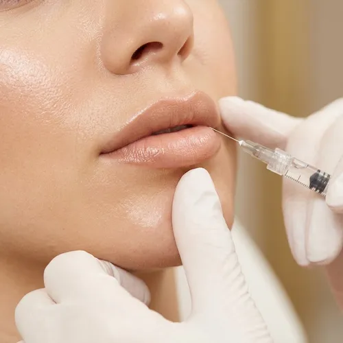 Aumento y Perfilado de Labios